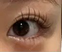目頭切開 9BeautyClinic BEFORE サムネイル用
