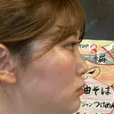 ヒアルロン酸注入（鼻） TCB東京中央美容外科 池袋駅前院 BEFORE サムネイル用