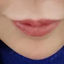 アートメイク（ほくろ） 新宿クレアクリニック BEFORE サムネイル用