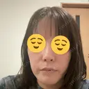 ダーマペン 美容皮膚科 デュークリニック BEFORE サムネイル用