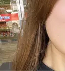 ボトックス（エラ・小顔） TCB東京中央美容外科 梅田茶屋町院 BEFORE サムネイル用