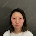 二重埋没 / 隆鼻術 / 脂肪吸引（顔） / タレ目形成・グラマラスライン（切開） / ヒアルロン酸注入（あご） ネビュラクリニック 京都院 BEFORE サムネイル用