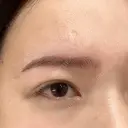眉下切開 Barbie Clinic BEFORE サムネイル用