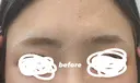 アートメイク（眉） セカジソウォン医院-明洞店 BEFORE サムネイル用
