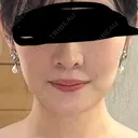 糸リフト / 脂肪吸引（顔） 東京ココセランクリニック BEFORE サムネイル用