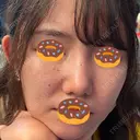 イオン導入 / ルメッカ ルラ美容クリニック 千葉院 / ルラスキンクリニック 千葉院 BEFORE サムネイル用