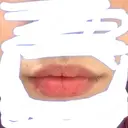 口唇縮小術 / PRP皮膚再生療法 品川スキンクリニック福岡院 BEFORE サムネイル用