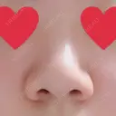 小鼻縮小（切開） ヴェリィ美容形成クリニック BEFORE サムネイル用