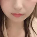 ヒアルロン酸注入（あご） TCB東京中央美容外科 世田谷院 BEFORE サムネイル用