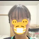 RF（高周波）たるみ治療 MEMOTO CLINIC 名古屋 BEFORE サムネイル用