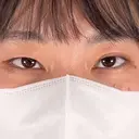 二重埋没 TCB東京中央美容外科 高崎院 BEFORE サムネイル用