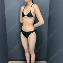 豊胸（シリコンバッグ） / 豊胸（脂肪注入） / 豊胸（シリコン＋脂肪併用） さくらビューティークリニック銀座 BEFORE サムネイル用