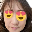 ボトックス（額） / ピーリング（ニキビ・毛穴） / イオン導入 CHARIS BEAUTY CLINIC BEFORE サムネイル用