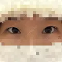 二重埋没 / 目尻切開 / タレ目形成・グラマラスライン（切開） YBC横浜美容外科 池袋院 BEFORE サムネイル用