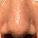 アグネス 日本美容・医療クリニック 六本木院 BEFORE サムネイル用