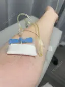 美容点滴・美容注射（美肌） Kinshicho Beauty Clinic （錦糸町ビューティークリニック） BEFORE サムネイル用