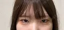 二重埋没 / 目頭切開 / 上まぶたの脂肪取り 9BeautyClinic BEFORE サムネイル用