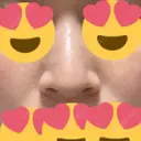 小鼻縮小（切開） アネシス美容クリニック BEFORE サムネイル用