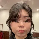 糸リフト / 脂肪吸引（顔） / ジョールファット除去 A CLINIC（エークリニック） 横浜院 BEFORE サムネイル用