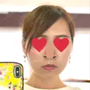 糸リフト / ヒアルロン酸注入（あご） / ボトックス（エラ・小顔） / 脂肪溶解注射（顔） 品川スキンクリニック熊本院 BEFORE サムネイル用