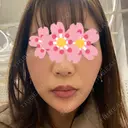 ハイフ（顔） 表参道メディカルクリニック 新宿院 BEFORE サムネイル用