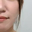 その他（鼻） / ボトックス（エラ・小顔） ルラ美容クリニック 渋谷本院 BEFORE サムネイル用