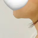 糸リフト / 脂肪吸引（顔） 福岡TAクリニック BEFORE サムネイル用