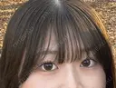 クマ治療 / 下まぶたの脂肪取り / ボトックス（エラ・小顔） / ボトックス（肩） TCB東京中央美容外科 大宮西口院 BEFORE サムネイル用