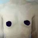 豊胸（シリコンバッグ） 共立美容外科 仙台院 BEFORE サムネイル用