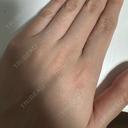 医療脱毛（全身） HINATA クリニック BEFORE サムネイル用
