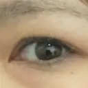 二重埋没 / 自然癒着法 Brandnew Beauty Clinic BEFORE サムネイル用