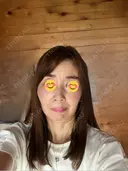 ルメッカ BAO CLINIC 神戸院 BEFORE サムネイル用