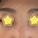 その他（目元） アネシス美容クリニック BEFORE サムネイル用