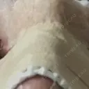 隆鼻術 / 鼻中隔延長（切開） 牧野皮膚科形成外科内科医院 美容外科・形成外科・抗加齢医学外来 BEFORE サムネイル用