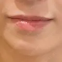 ヒアルロン酸注入（唇） Wi Clinic （ウィ クリニック）心斎橋院 BEFORE サムネイル用