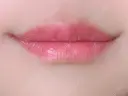 口唇縮小術 くさのたろうクリニック BEFORE サムネイル用