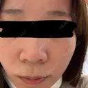 ポテンツァ ルラ美容クリニック 札幌本院 BEFORE サムネイル用