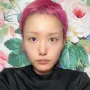 骨切り（あご） / 骨削り（エラ） / 骨削り（頬） / ルフォー+ssro（両あご) id（アイディ）美容外科 BEFORE サムネイル用