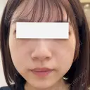 ルメッカ 大美会クリニック 天王寺院 BEFORE サムネイル用