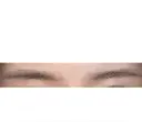 アートメイク除去・修正 しのぶ皮膚科 BEFORE サムネイル用