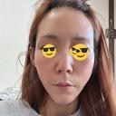 鼻尖形成（切開） / 鼻中隔延長（切開） / 糸リフト / 軟骨移植 / 骨切幅寄せ / 鼻孔縁挙上 / 鼻柱下降・鼻唇角形成（猫手術） / 肌ヒアルロン酸注入（たるみ・シワ改善） / ヒアルロン酸注入（あご） / ボトックス（額） / ヒアルロン酸注入（鼻翼基部） 大阪TAクリニック BEFORE サムネイル用