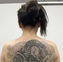 ボトックス（肩） YBC横浜美容外科 大宮院 BEFORE サムネイル用