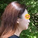 脂肪吸引（顔） / ヒアルロン酸注入（あご） HAAB×DREAM BEAUTY CLINIC 東京本院 BEFORE サムネイル用