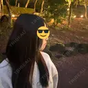 ボトックス（あご） / ヒアルロン酸注入（あご） / ボトックス（エラ・小顔） TCB東京中央美容外科 静岡院 BEFORE サムネイル用