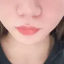 その他（輪郭） ルラ美容クリニック 沖縄院 BEFORE サムネイル用