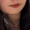 ヒアルロン酸注入（涙袋） / ヒアルロン酸注入（唇） / ボトックス（口角） ルラ美容クリニック 札幌本院 BEFORE サムネイル用