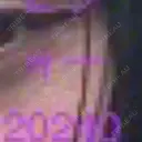 ボトックス（タレ目） / ボトックス（目尻） 品川美容外科 新宿院（※品川スキンクリニック提携） BEFORE サムネイル用