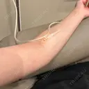 白玉点滴・注射 グリシーヌクリニック BEFORE サムネイル用