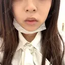 ヒアルロン酸注入（唇） / ボトックス（口角） ルラ美容クリニック 大阪本院 BEFORE サムネイル用
