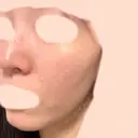 ピーリング（ハリ・ツヤ） 大美会クリニック 梅田院 BEFORE サムネイル用